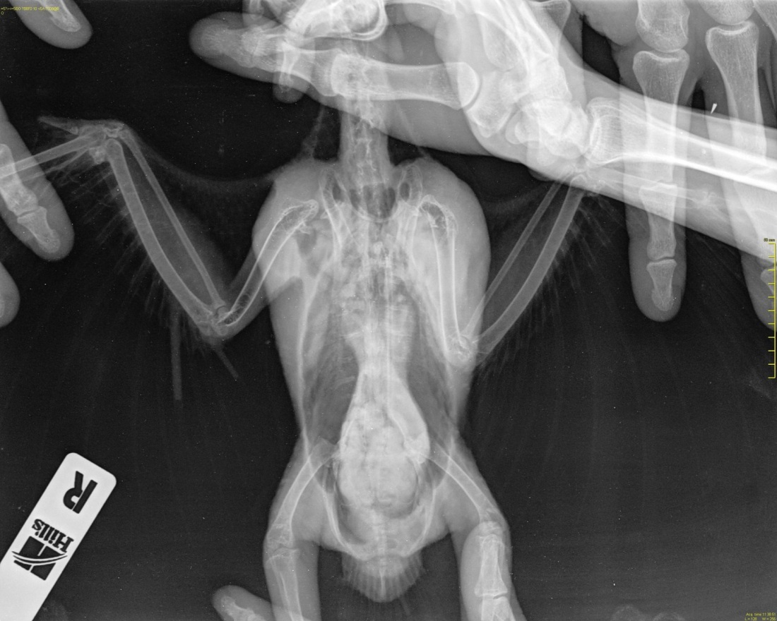 Голые на рентгене