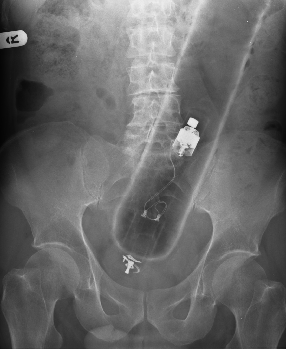 Половые органы на рентгене
