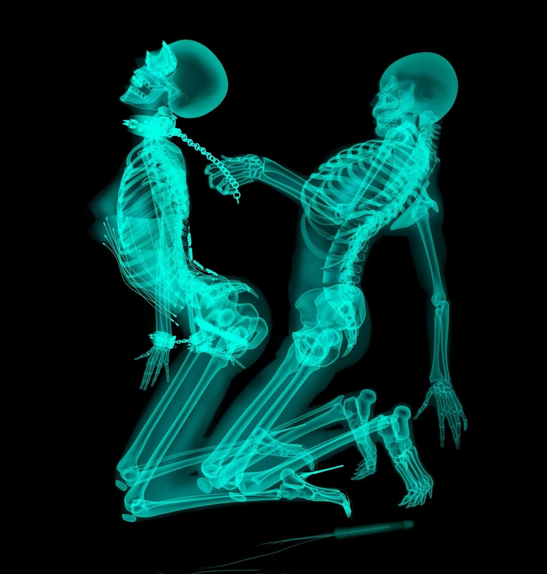 Эротические рентгеновские снимки