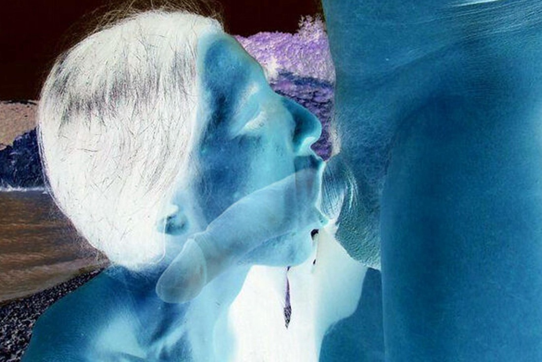 Рентгеновский снимок горлового минета