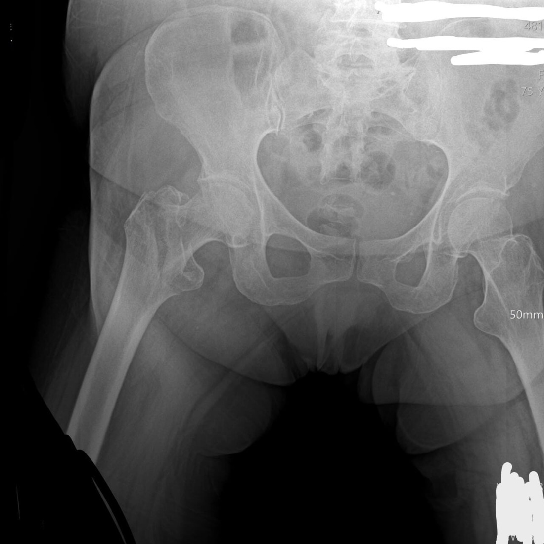 Рентгеновские снимки девушек