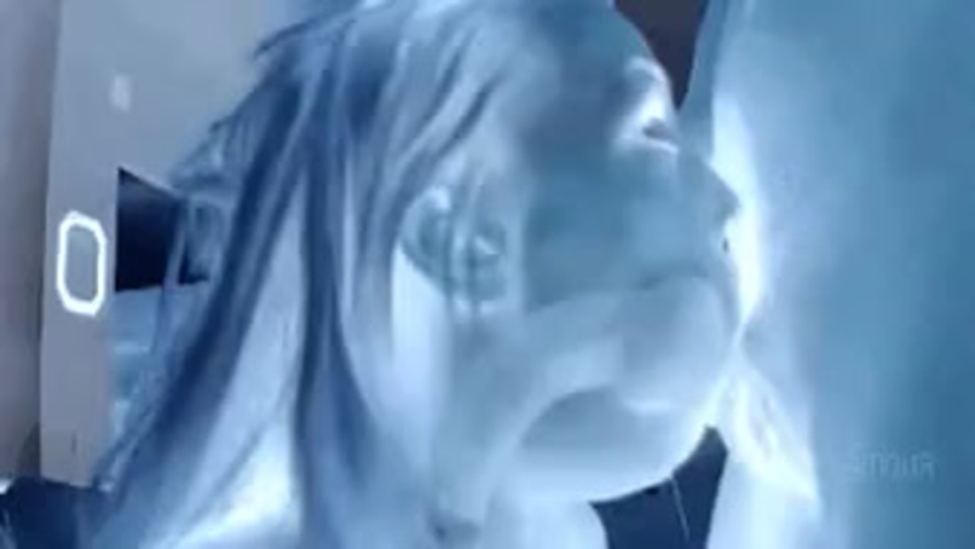 Рентгеновские снимки минета